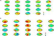 EEG artifact removal using sub-space decomposition, nonlinear dynamics, stationary wavelet transform and machine learning algorithms